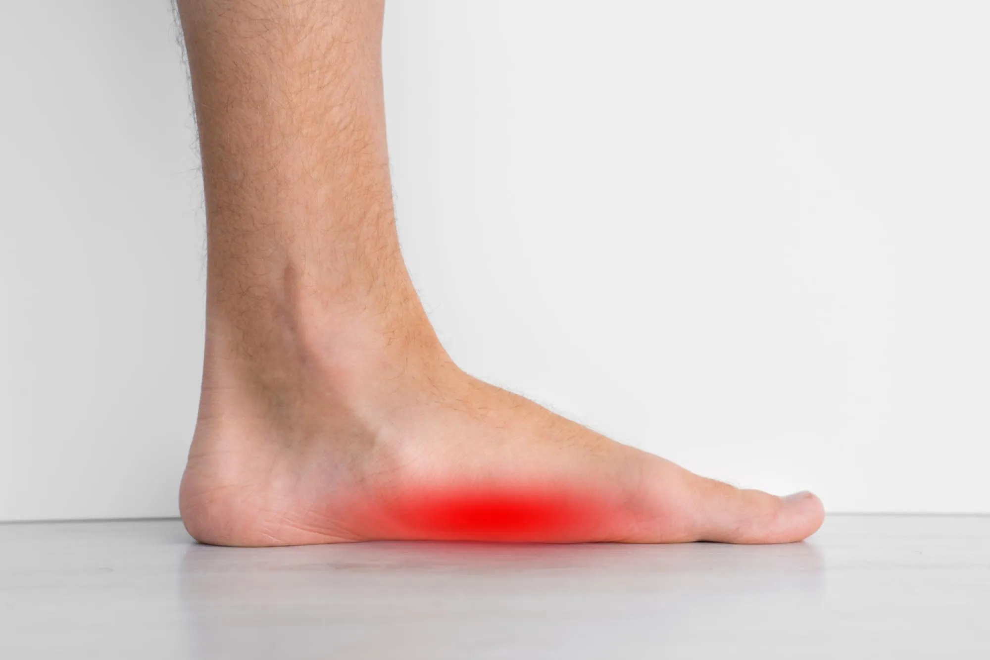 Pied nu posé au sol, zone de douleur en rouge sous la voûte plantaire